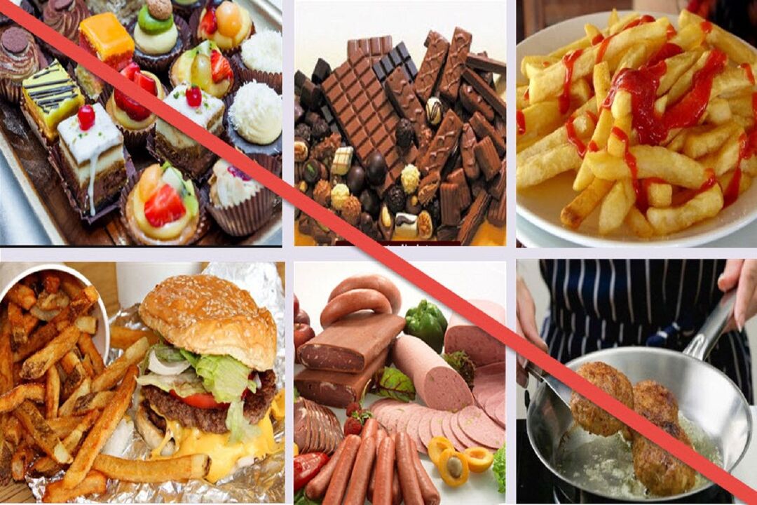 aliments interdits dans un régime